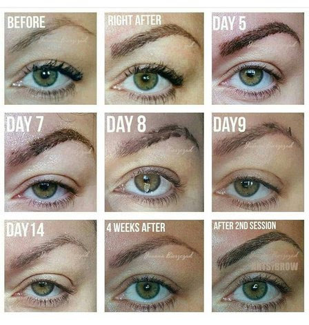 brow recovery