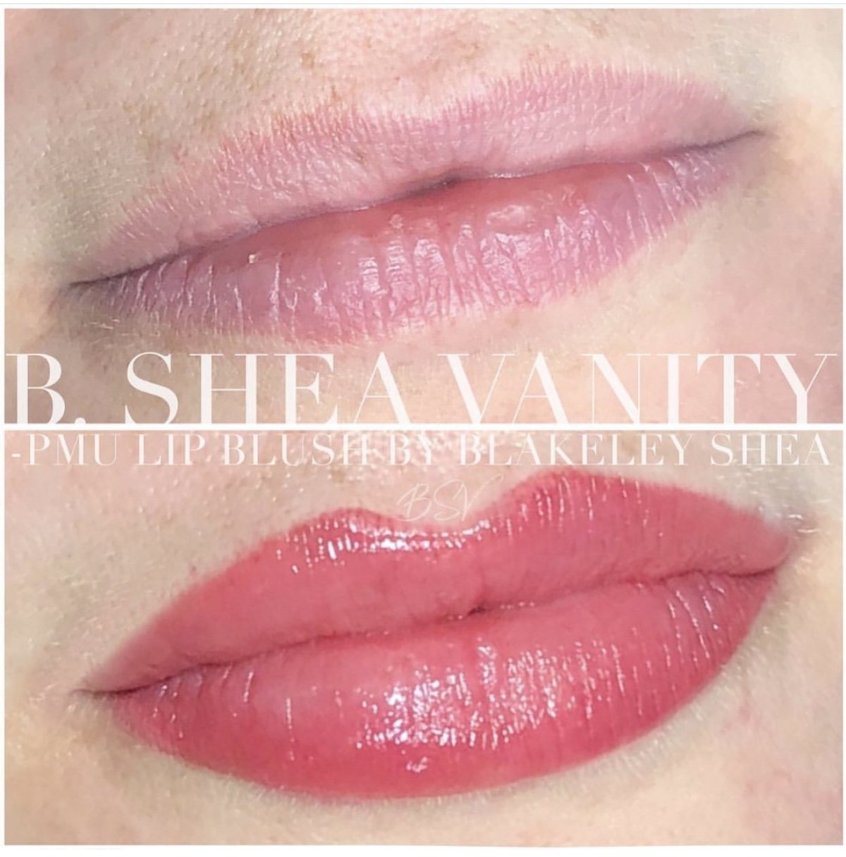 lips