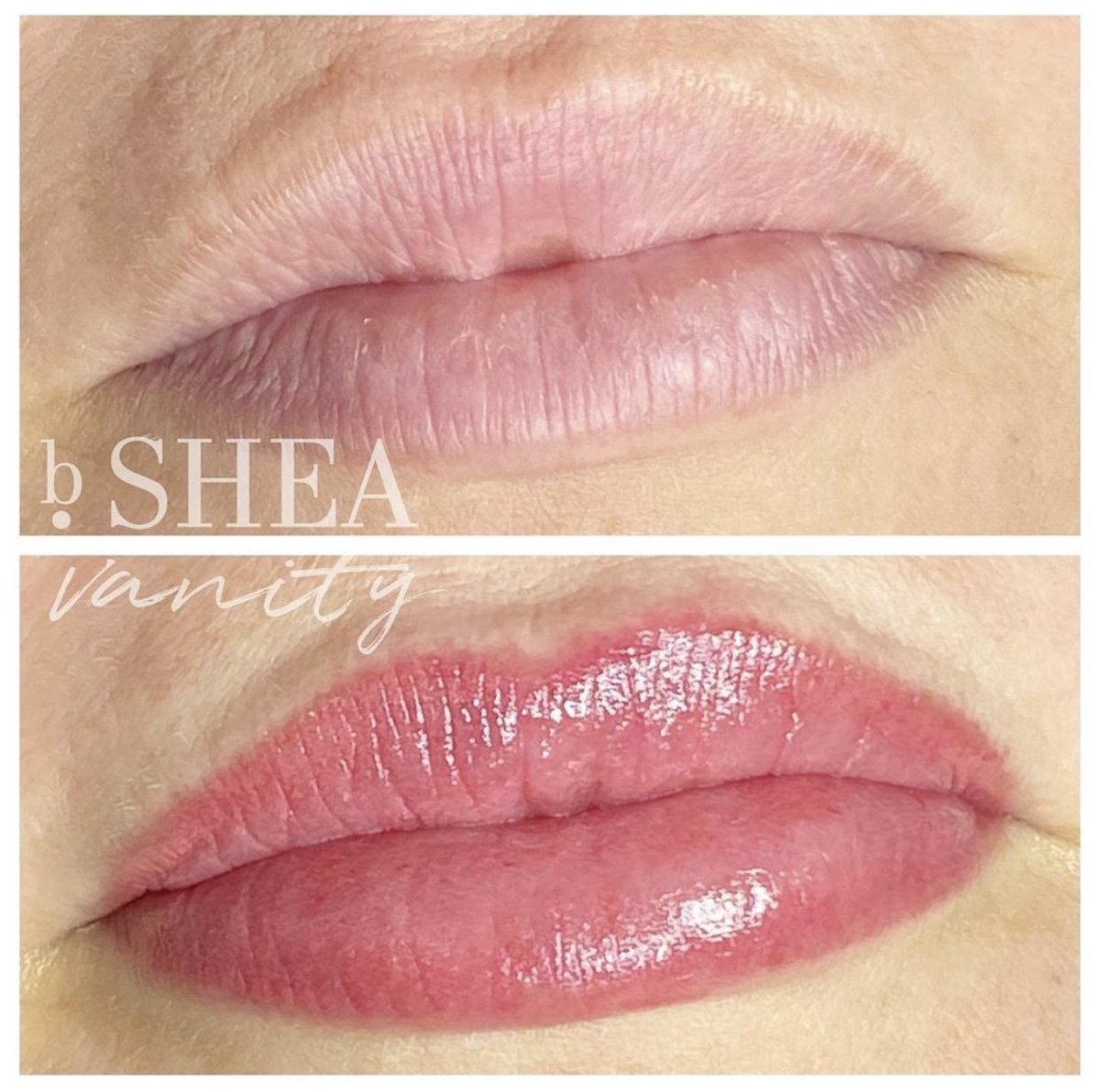 lips